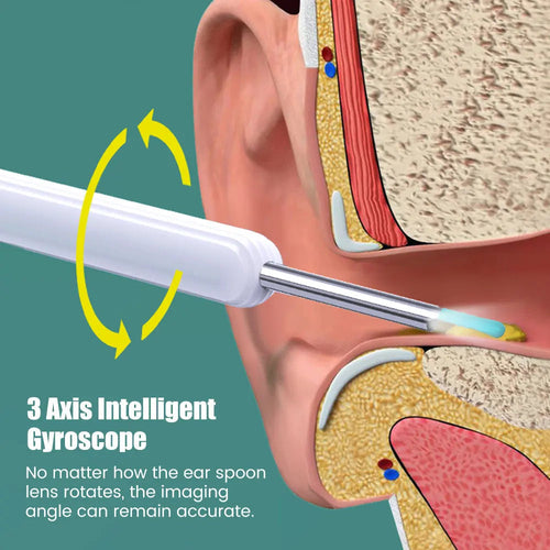 Smart Visual Earpick Ear Wax Removal Tool Endoscope Spoon 1296P HD Ear
